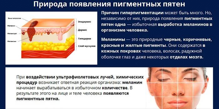 Природа появления пигментных пятен