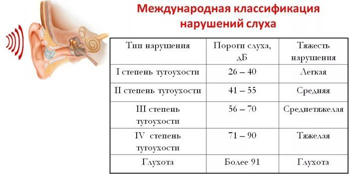 Международная классификация