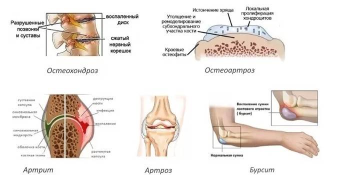 Заболевания, при которых применяется препарат