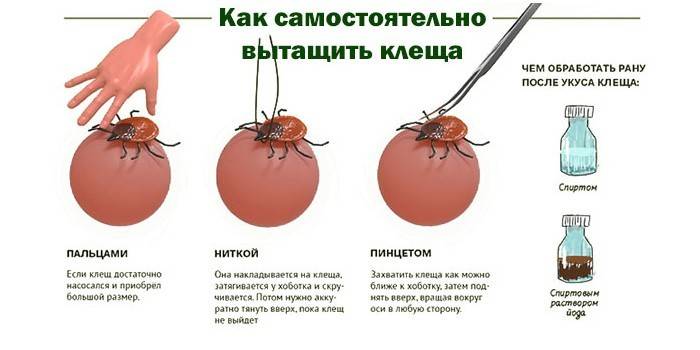 Методы извлечения клеща у собаки