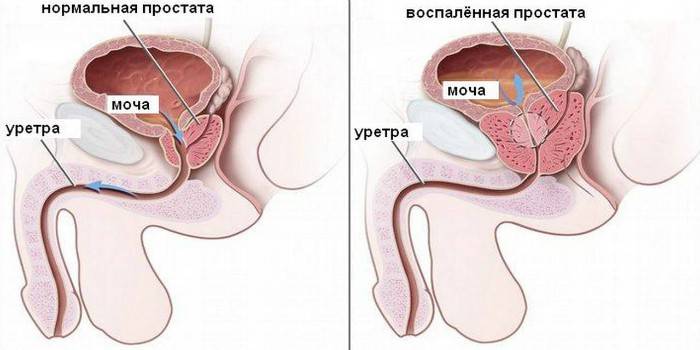 Схема мужской мочеполовой системы