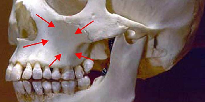 Расположение гайморовой пазухи на черепе человека