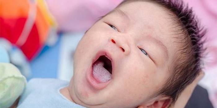 Белые губы у новорожденного после кормления 19