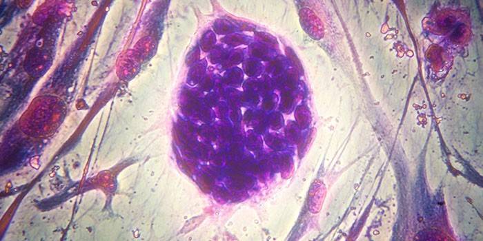 Фетальные стволовые клетки под микроскопом