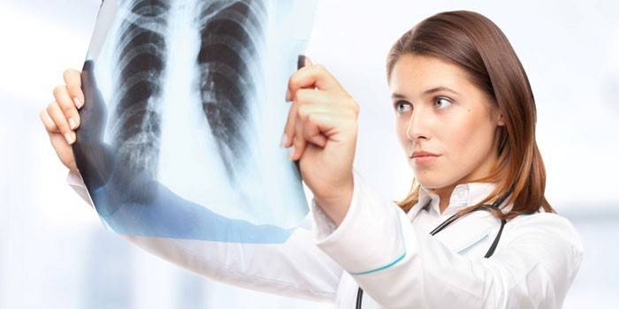 Медик смотрит на рентгеновский снимок легких