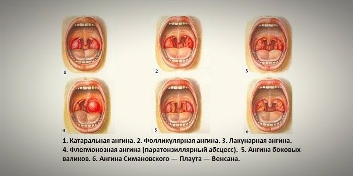 прически для узкого вытянутого лица фото с высоким лбом