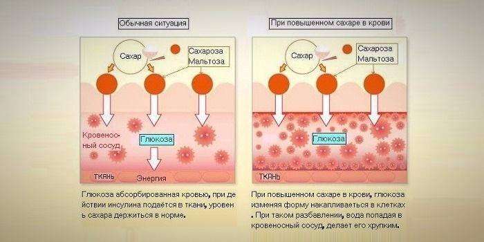 Схема влияния глюкозы на кровь