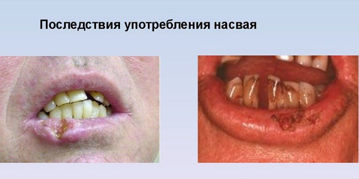 Последствия