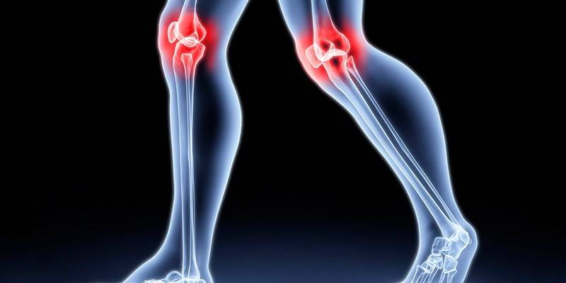 Воспаление коленных суставов