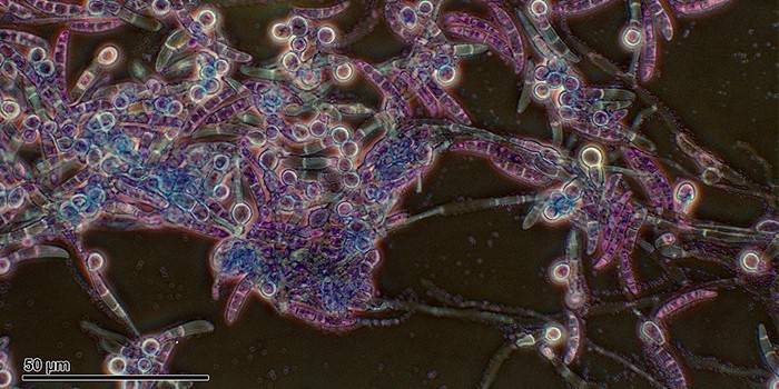 Бактерия Pythium под микроскопом