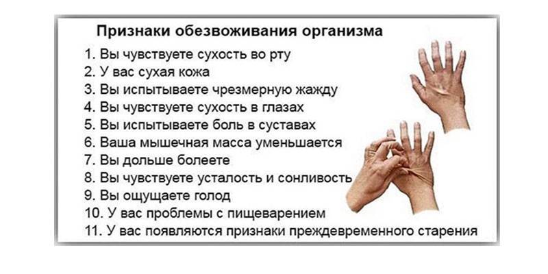 Признаки обезвоживания