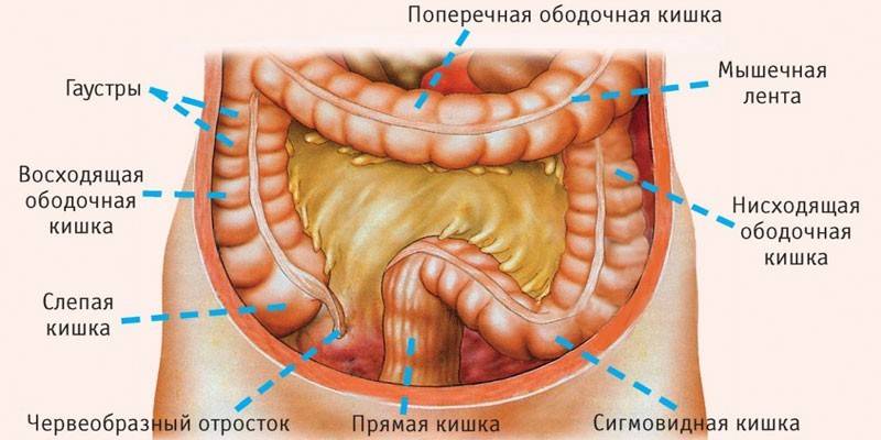 Эндометриоз кишечника диагностика 12