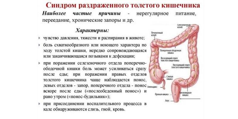Симптомы синдрома раздраженного кишечника
