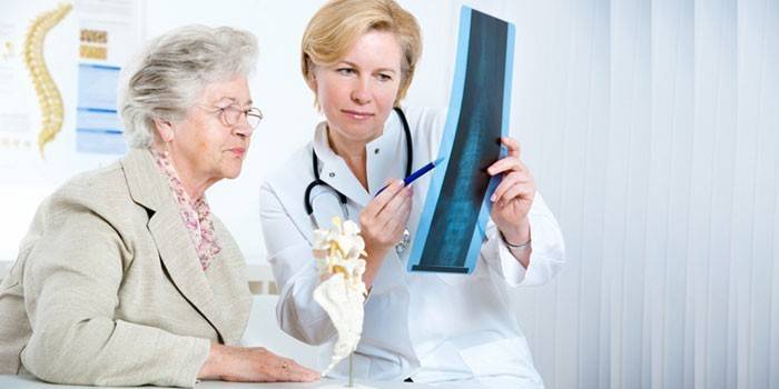 Врач показывает пожилой пациентке рентгеновский снимок