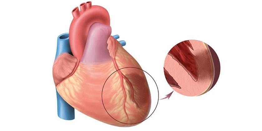Схема сердечной мышцы