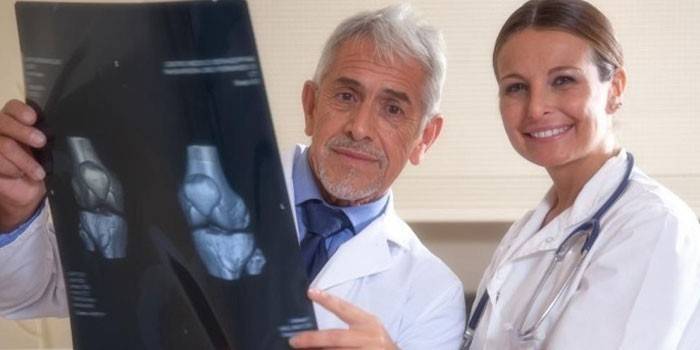 Медики рассматривают рентгеновский снимок суставов