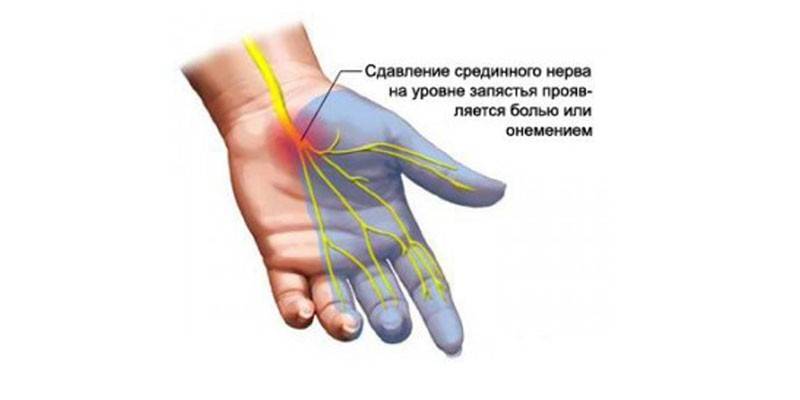 Расположение серединного нерва на руке
