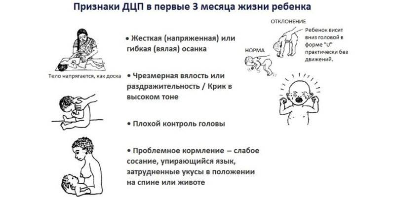 Признаки ДЦП в первые 3 месяца