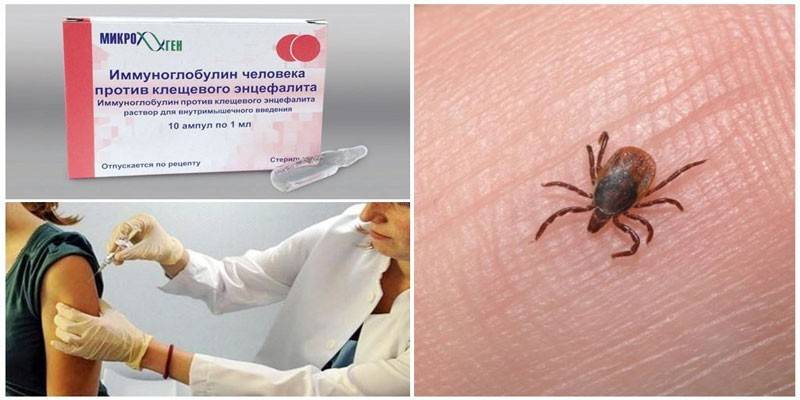 Иммуноглобулин противоклещевой